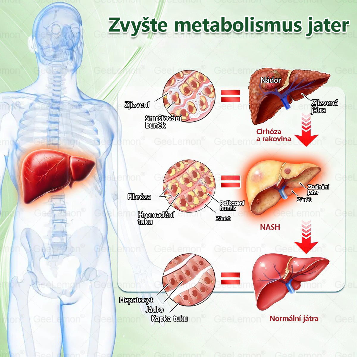 👩‍⚕️ 🎁 𝐆𝐞𝑒𝑙𝑒𝐦𝐨𝐧® Glum𝐚𝐬𝐞tide 8 v 1 – Zeštíhlující nano mikrojihlový náplast 🇨🇿 Jen 1× denně ✅ Viditelné změny za 7 dní – na obezitu, kardiovaskulární zdraví, diabetes a kloubní problémy