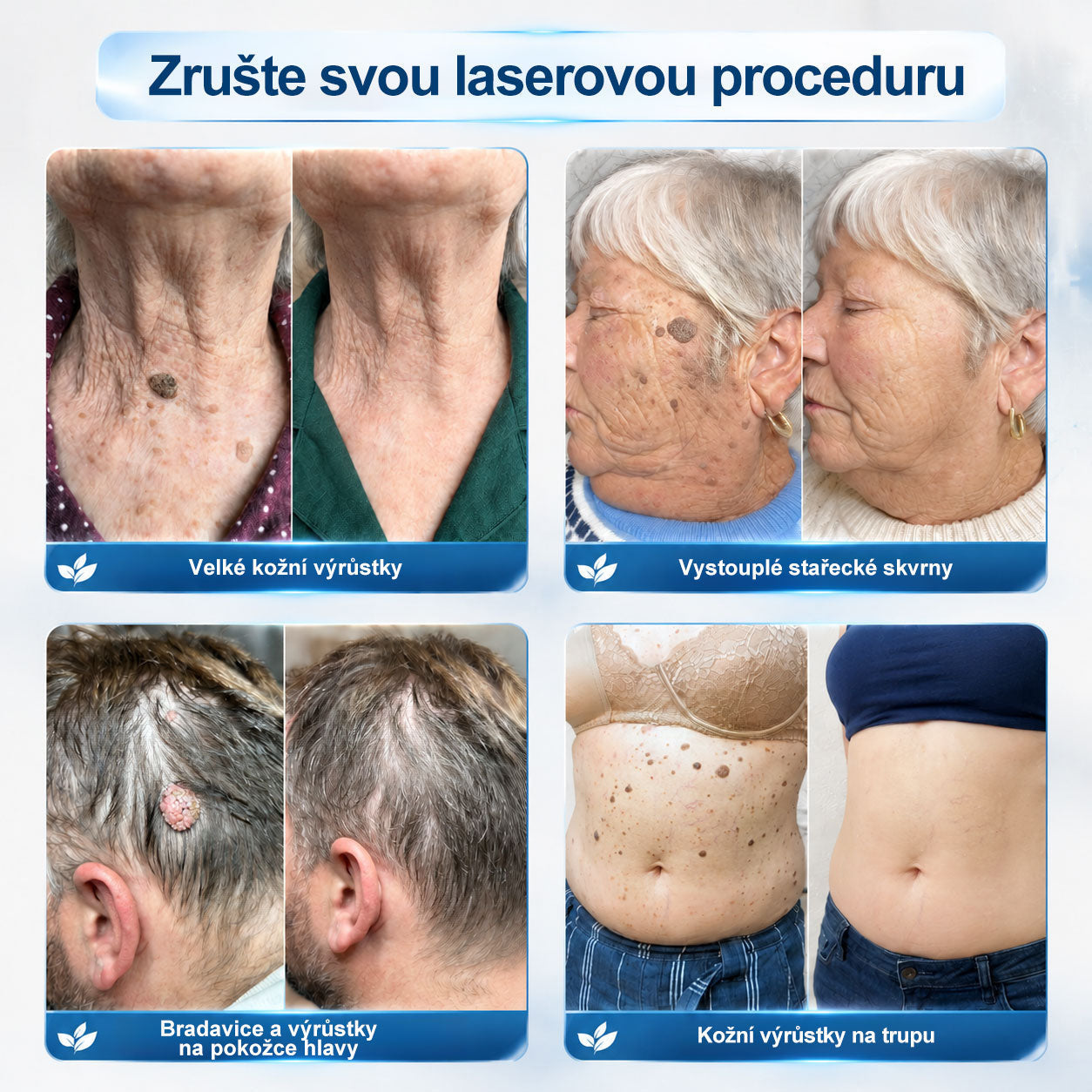 Oficiální značkový obchod | Hiskin® 7denní odstraňovač skvrn a pigmentových skvrn (Bezbolestný rollerball bez jizev)🐬