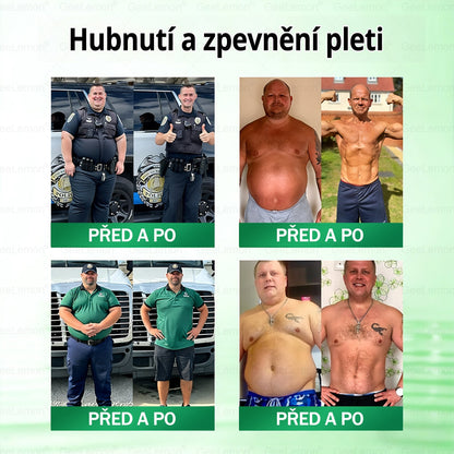 👩‍⚕️ 🎁 𝐆𝐞𝑒𝑙𝑒𝐦𝐨𝐧® Glum𝐚𝐬𝐞tide 8 v 1 – Zeštíhlující nano mikrojihlový náplast 🇨🇿 Jen 1× denně ✅ Viditelné změny za 7 dní – na obezitu, kardiovaskulární zdraví, diabetes a kloubní problémy