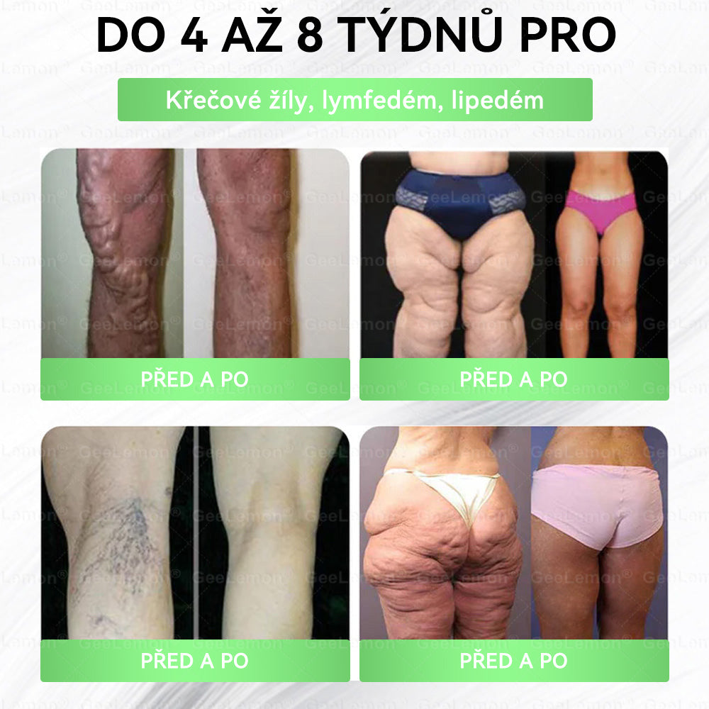 👩‍⚕️ 🎁 𝐆𝐞𝑒𝑙𝑒𝐦𝐨𝐧® Glum𝐚𝐬𝐞tide 8 v 1 – Zeštíhlující nano mikrojihlový náplast 🇨🇿 Jen 1× denně ✅ Viditelné změny za 7 dní – na obezitu, kardiovaskulární zdraví, diabetes a kloubní problémy