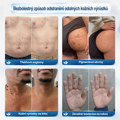 Oficiální značkový obchod | Hiskin® 7denní odstraňovač skvrn a pigmentových skvrn (Bezbolestný rollerball bez jizev)🐬
