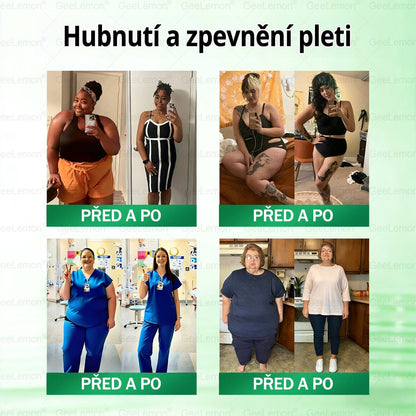 👩‍⚕️ 🎁 𝐆𝐞𝑒𝑙𝑒𝐦𝐨𝐧® Glum𝐚𝐬𝐞tide 8 v 1 – Zeštíhlující nano mikrojihlový náplast 🇨🇿 Jen 1× denně ✅ Viditelné změny za 7 dní – na obezitu, kardiovaskulární zdraví, diabetes a kloubní problémy